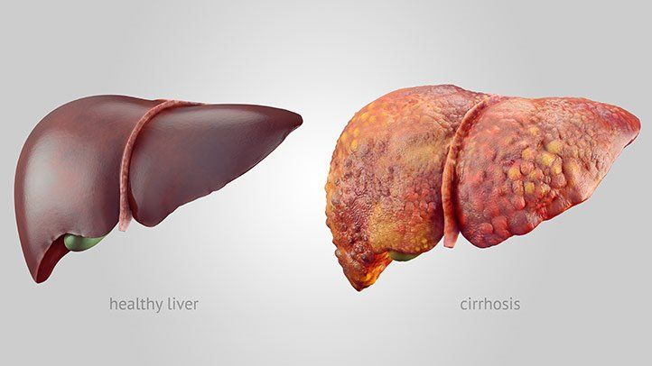 signs and symptoms of liver problem